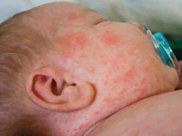 QIZAMIQDAN KEYINGI ASORATLAR